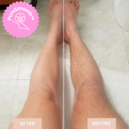 LuxeLaser Flawless Hair Removal in 60 Seconds
