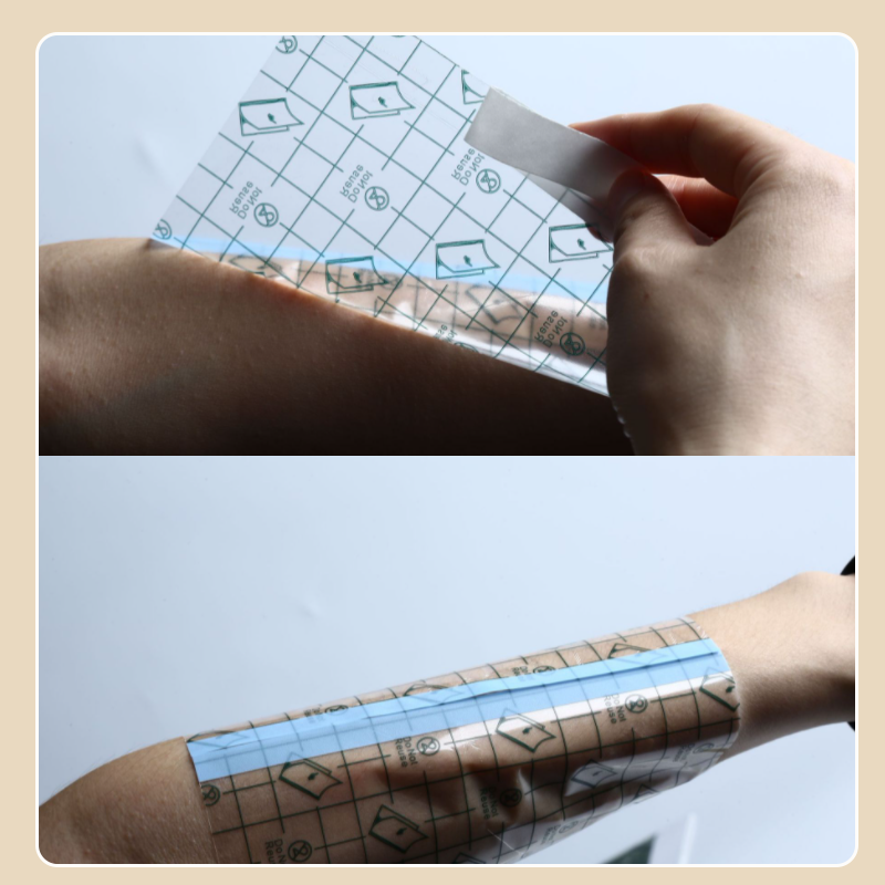 Waterproof Transparent Bandage