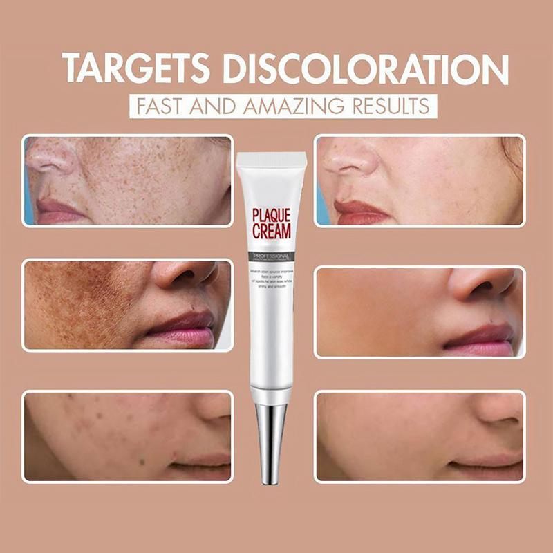 Face Freckles Removal Cream