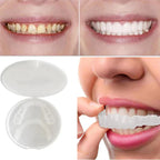 SnapFit Dental Restoration | Always a Flawless Smile