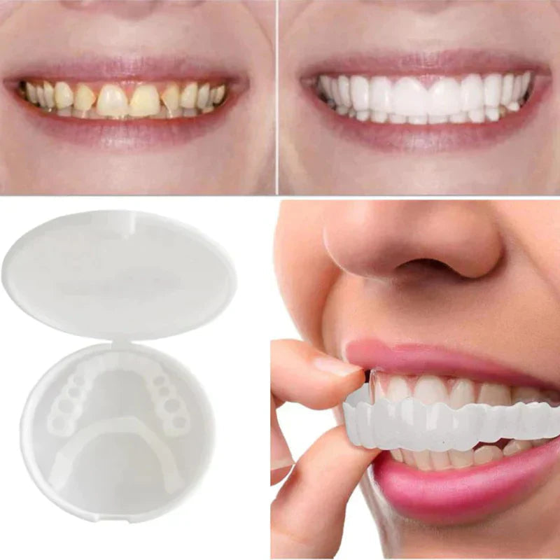 SnapFit Dental Restoration | Always a Flawless Smile