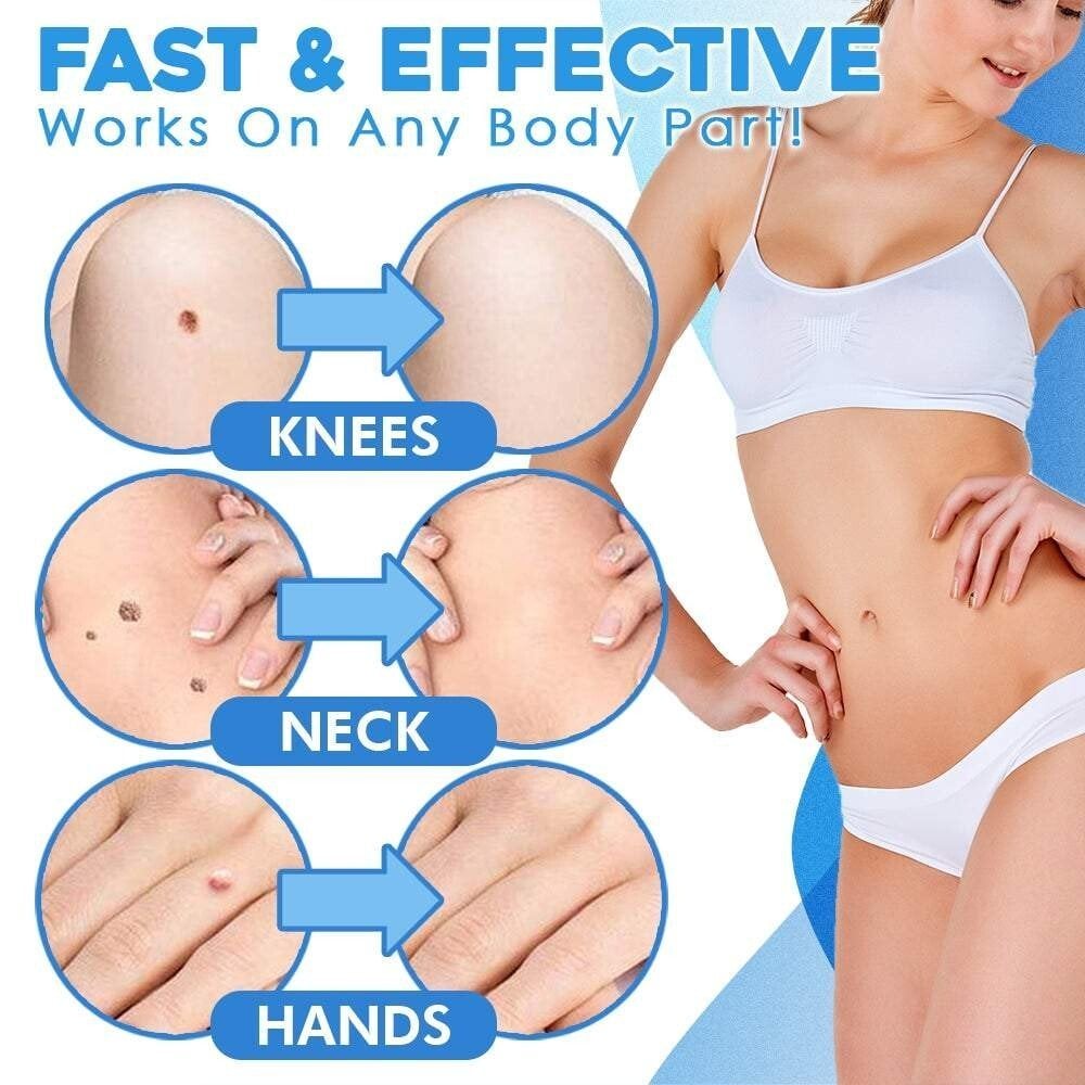 SmoothZap — Pain-free skin freedom for a new sense of confidence in just 10 days
