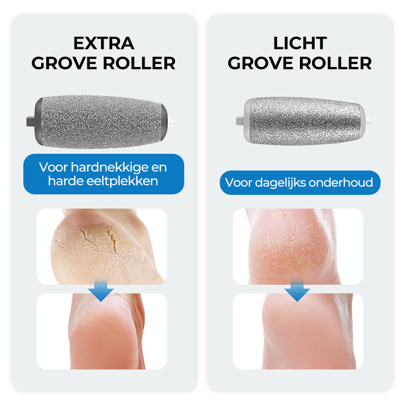 SmoothFoot – Achieve silky smooth feet in just a few minutes