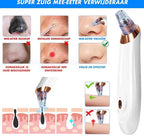 Electric Blackhead Remover