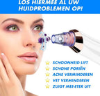 Electric Blackhead Remover
