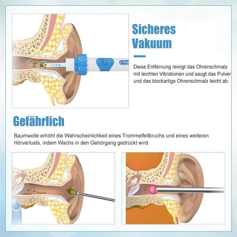 Earwax remover vacuum