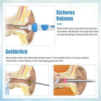 Earwax remover vacuum