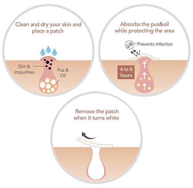 Skin Tag and Acne Patch