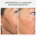 YouthMorph — Tight skin in minutes for your youthful WOW moment