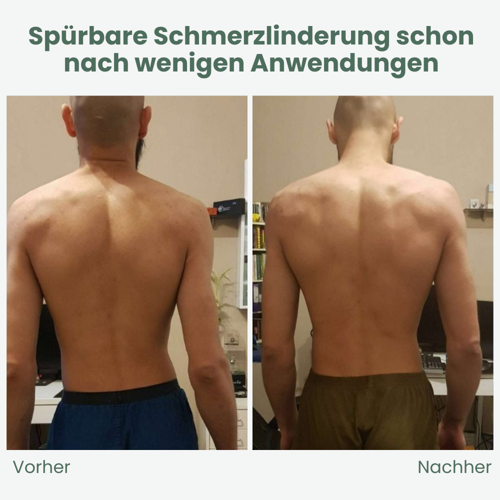 Back Hero — Pain-free upright & self-confident through the day