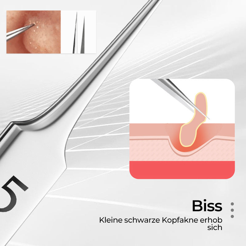 Tweezer for Removing Blackheads on the Face