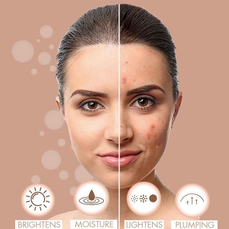Face Freckles Removal Cream