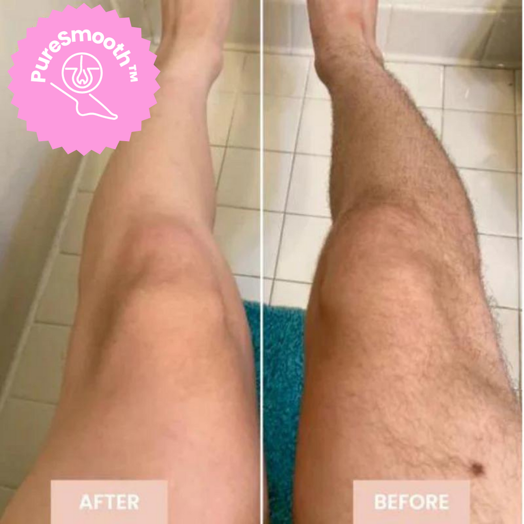 LuxeLaser Flawless Hair Removal in 60 Seconds