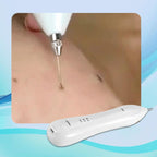 Facial Hair Removal Pen
