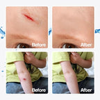 Waterproof Liquid Bandage