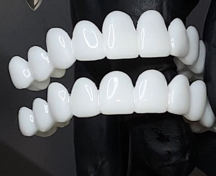 Cosmetic Tooth Toppers SmileShape – Reusable, Flexible and Naturally White