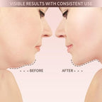 VitaLift – Naturally beautiful at any age