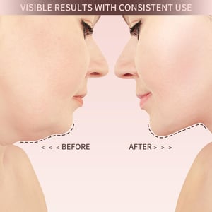VitaLift – Naturally beautiful at any age