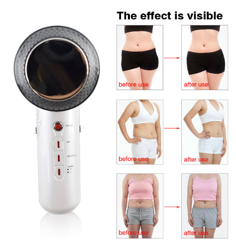 Ultrasound Massage Device