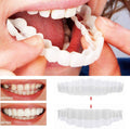 On Smile Veneers (Upper and Lower Jaw included)