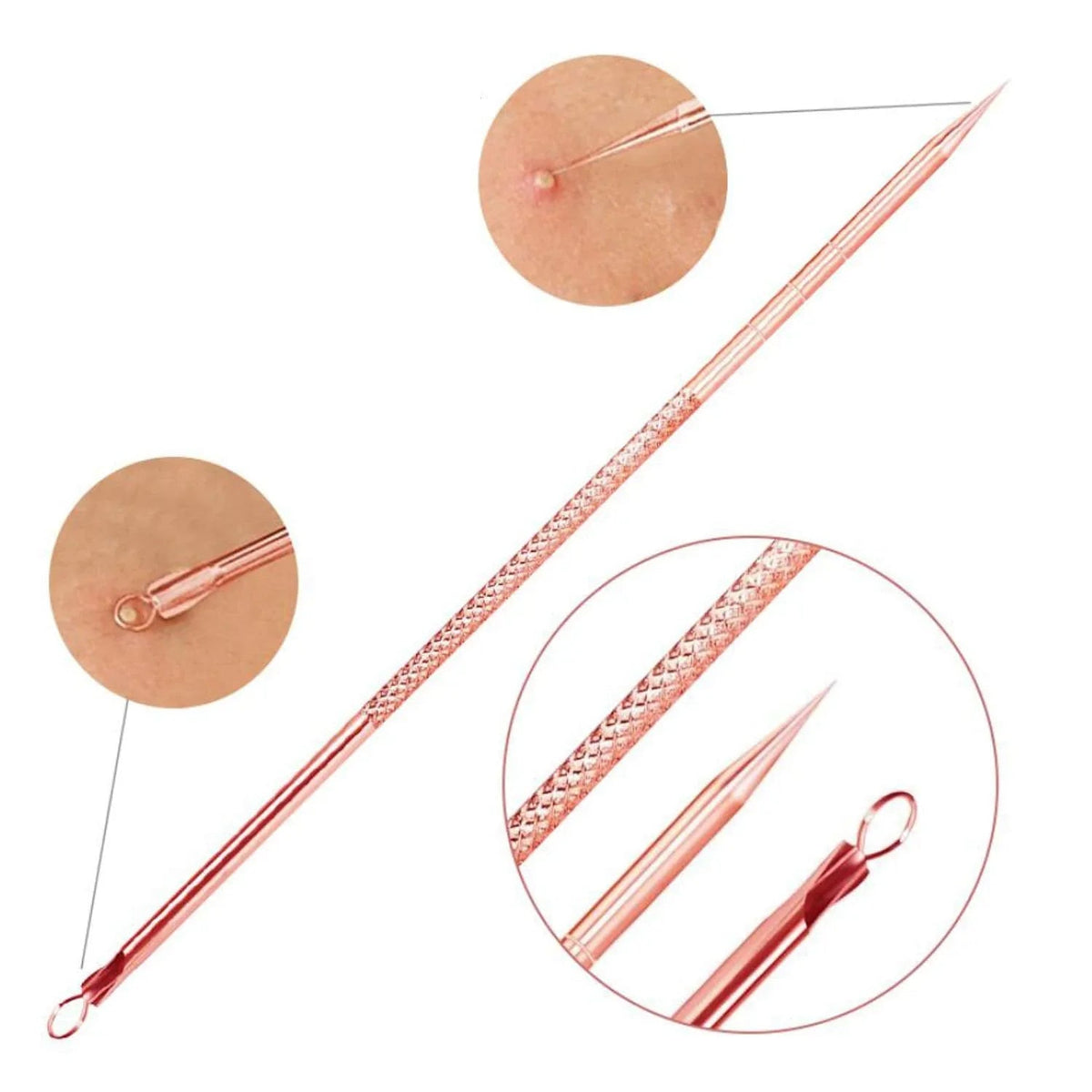 Blackhead and pimple removal set