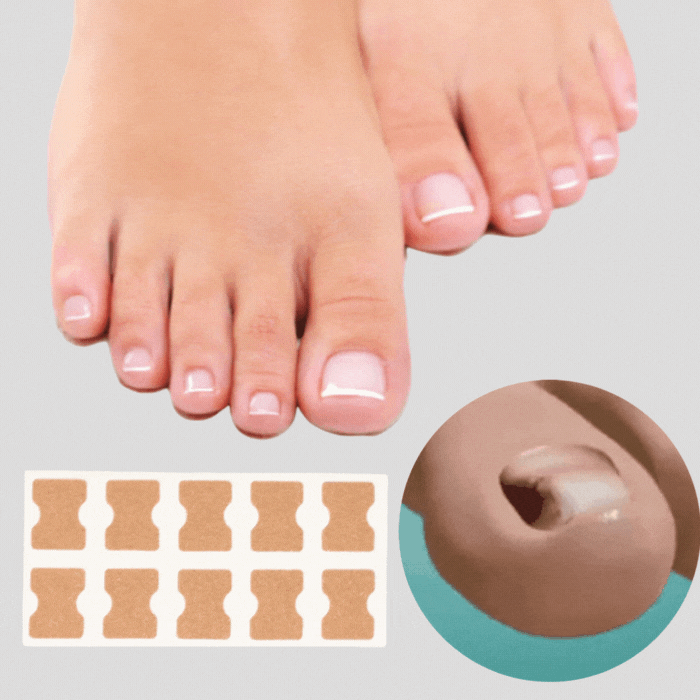 ProFlexiPatches — Pain-free natural nails that you show off again with pride