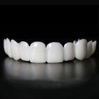 Instant Smile Transformation with Snap on Smile Veneers