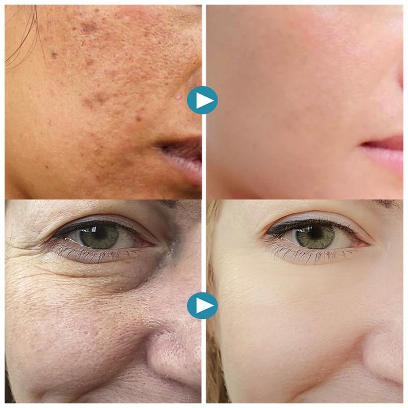 SilkPores | Smooth and radiant skin