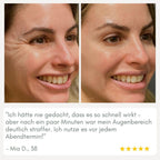 YouthMorph — Tight skin in minutes for your youthful WOW moment