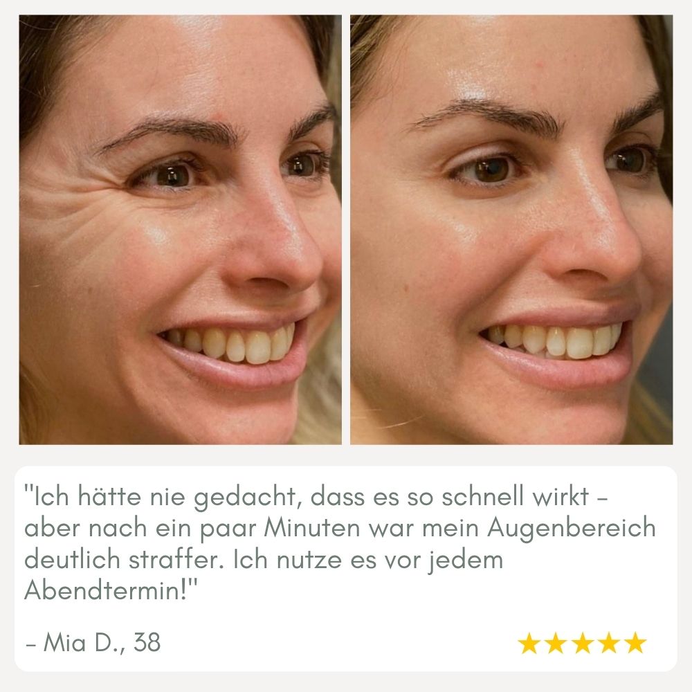 YouthMorph — Tight skin in minutes for your youthful WOW moment