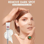 Face Freckles Removal Cream