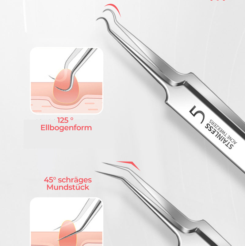 Tweezer for Removing Blackheads on the Face