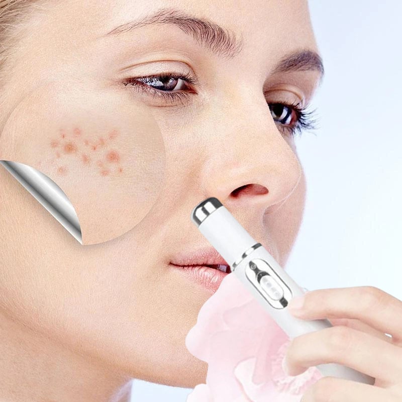 ClearDerm - Quick, painless pimple removal for smooth, clear skin