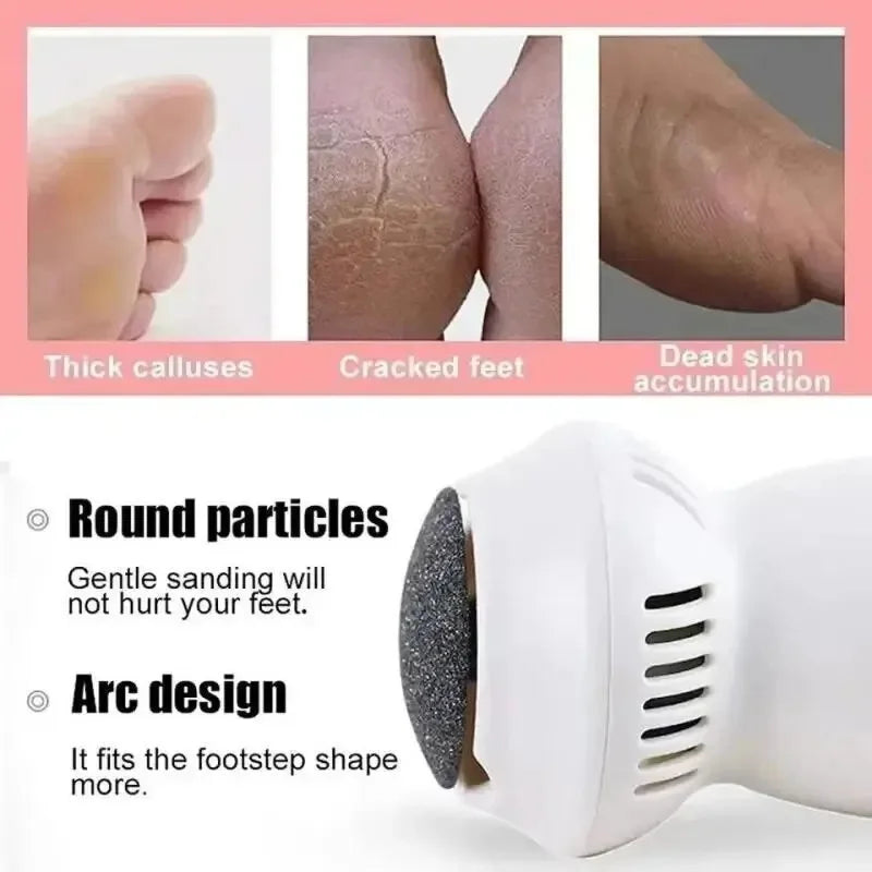 Electric Professional Callus Remover