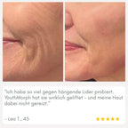 YouthMorph — Tight skin in minutes for your youthful WOW moment