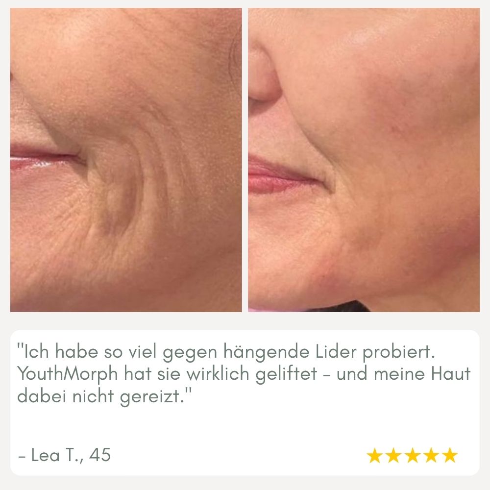 YouthMorph — Tight skin in minutes for your youthful WOW moment