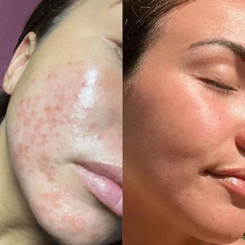 LumiGlow - Pain-Free Treatment: Non-Invasive Therapy