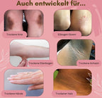 Dermashield — Quick relief for cracked, itchy feet that want to breathe freely