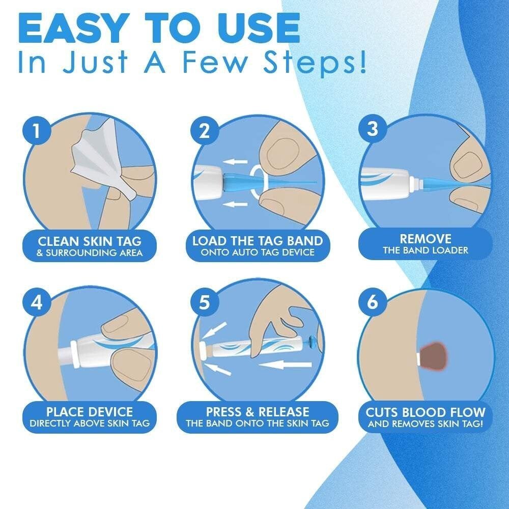 SmoothZap — Pain-free skin freedom for a new sense of confidence in just 10 days