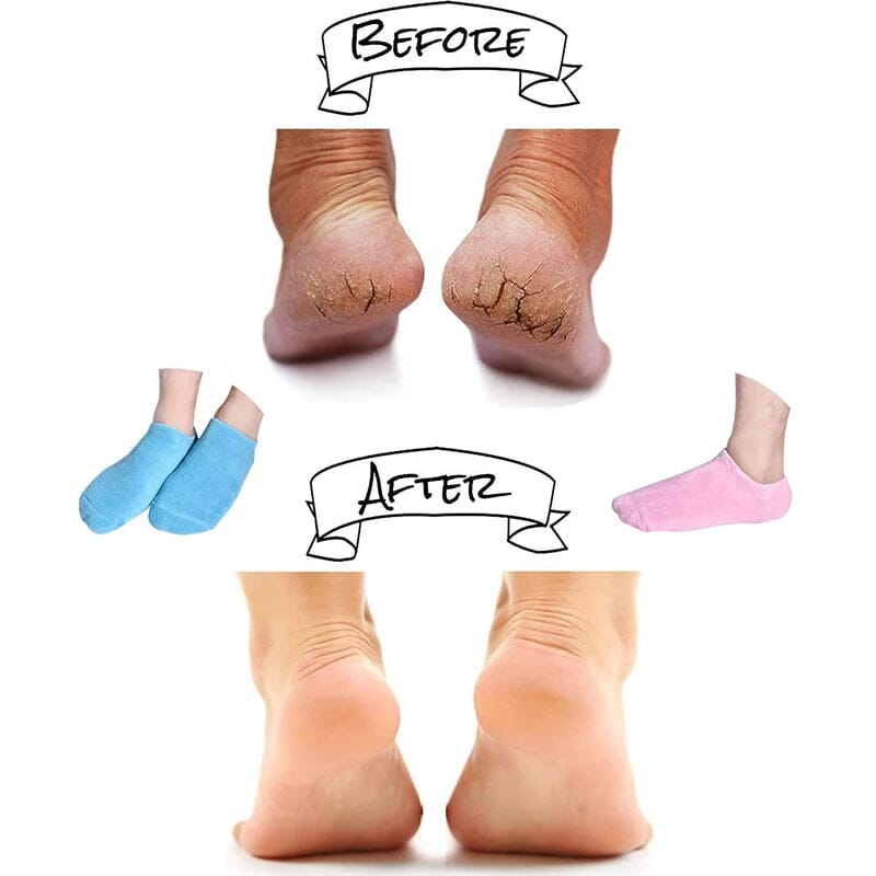 Moisturizing socks with gel lining