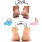 Moisturizing socks with gel lining