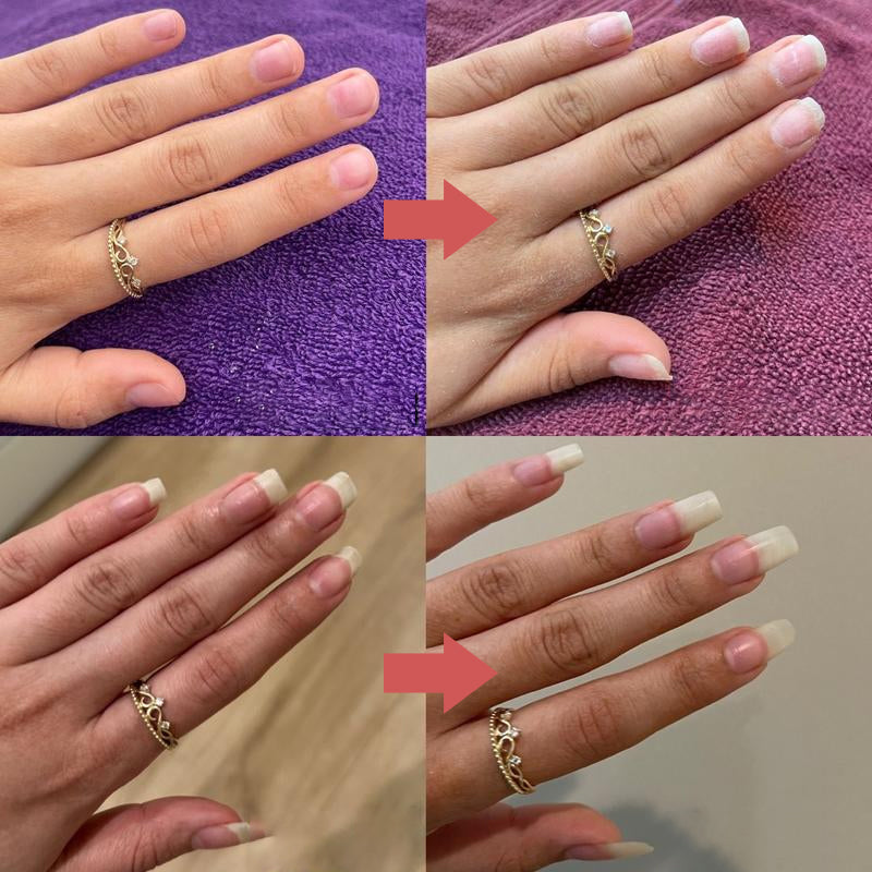 Nails Nutrient-Rich Growth Oil