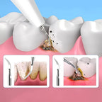 PlaqueFree Plaque Remover for teeth | Ultrasonic Teeth Cleaner - Tartar Remover from Home - Deep Teeth Cleaning and Polish