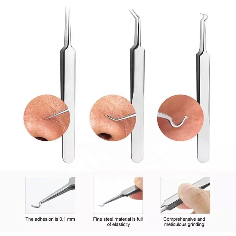 Tweezer for Removing Blackheads on the Face