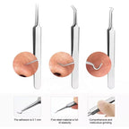 Tweezer for Removing Blackheads on the Face