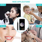 Wireless Earwax Remover Tool