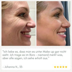 YouthMorph — Tight skin in minutes for your youthful WOW moment