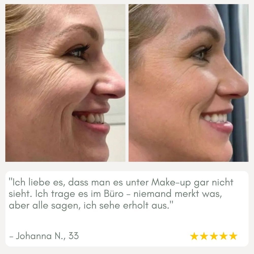 YouthMorph — Tight skin in minutes for your youthful WOW moment
