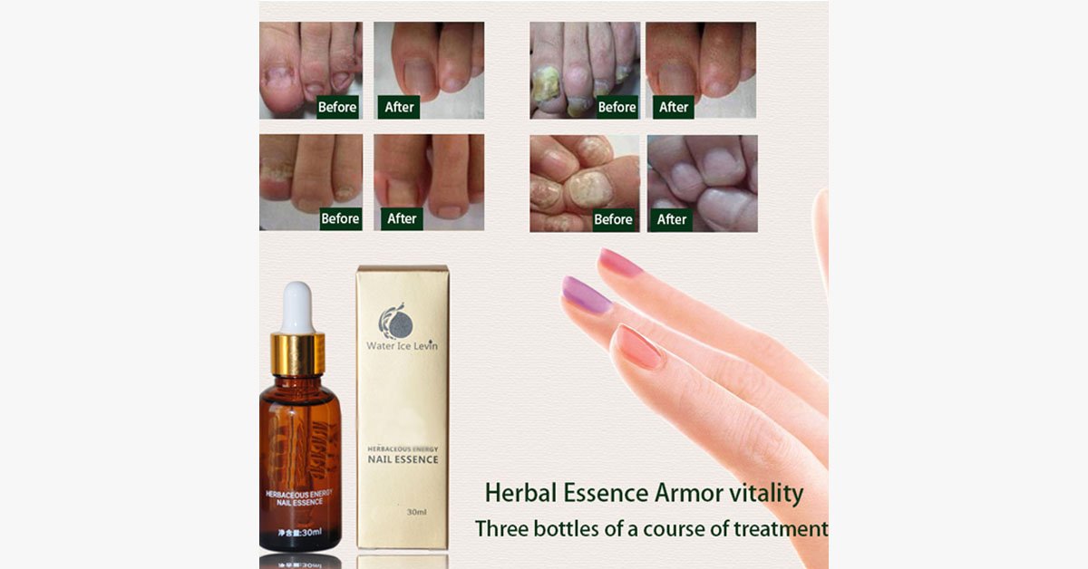 Wonder Nail Essence – The best solution for healthy nails