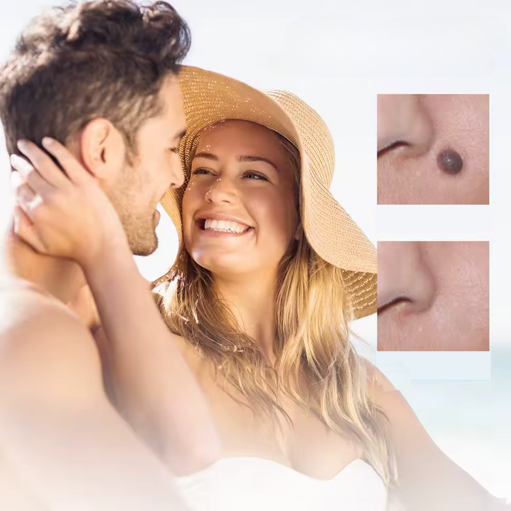 WartAway – Remove warts, completely without chemicals!